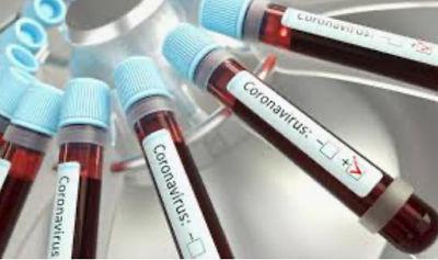 pandemia opt